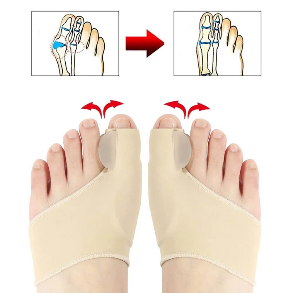 Orthèse Hallux Valgus - Correcteur Orteil